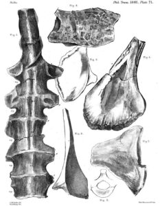 Lomber Fraktür Örnek Çizimlerini Gösteren Resim - Doç. Dr. Ümit Eroğlu Beyin Cerrahisi