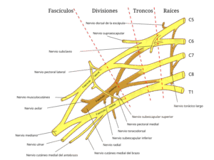 Brakial pleksus sinir yaralanmasını gösteren tıbbi görüntü, sinir cerrahisi uzmanı Dr. Ümit Eroğlu
