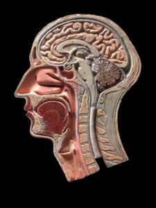 Hipofiz adenomu tümörünü gösteren beyin görüntüsü, Dr. Ümit Eroğlu beyin ve sinir cerrahisi uzmanı için